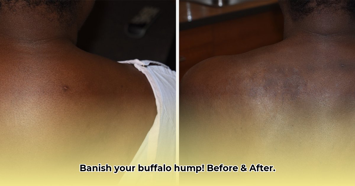 buffalo-hump-before-and-after-weight-loss